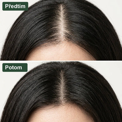 Předtím a potom