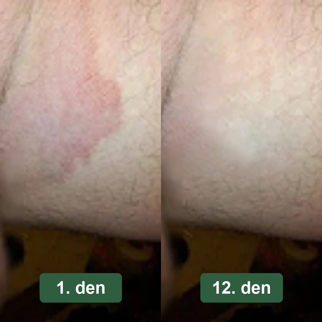 Předtím a potom