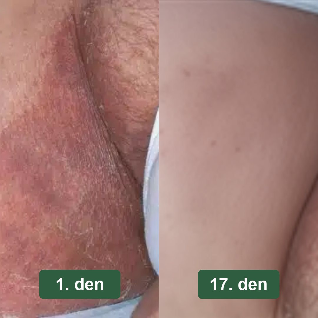 Předtím a potom