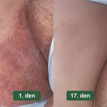 Předtím a potom