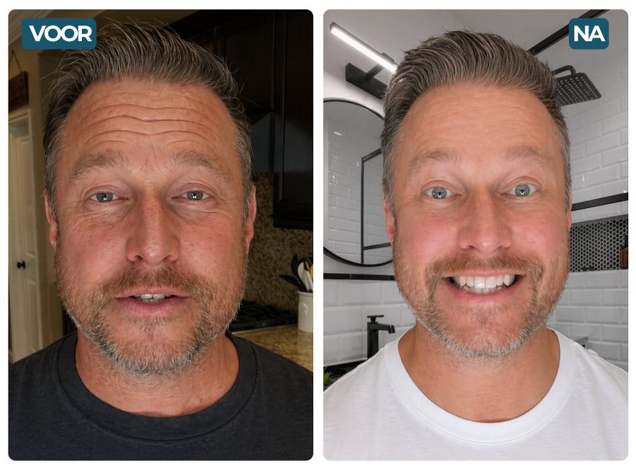 David, 49 — před / po